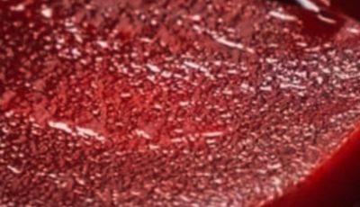 Doctors Reveal What Eating Beets Really Does to Your Body
