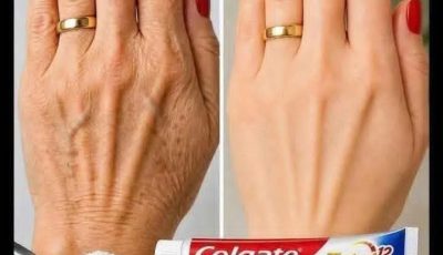 Search Results for: Look at this… these hands looked aged, full of spots