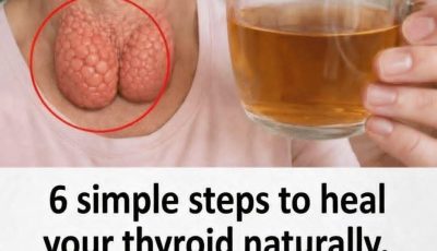 Simple Steps to Support Thyroid Health Naturally