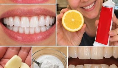 How to Whiten Teeth Naturally at Home: Easy Remedies and Daily Habits for a Brighter Smile