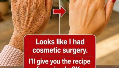 Are Your Hands Revealing Your Age Faster Than Your Face? Simple Habits That May Help Improve the Look of Wrinkles and Dark Spots