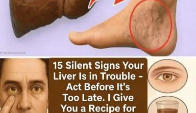15 Silent Signs Your Liver May Be in Trouble