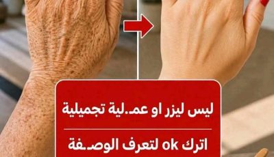 You’ll never need expensive recipes to take care of your skin! Natural masks will give you clear, glass-like skin, free from blemishes and wrinkles… To continue receiving my recipes, simply leave a comment “ok”…! And see the first comment.