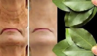 Bay Leaf Is 100,000 Times StrongerThan Botox?Natural WrinkleEraser Even at Age70