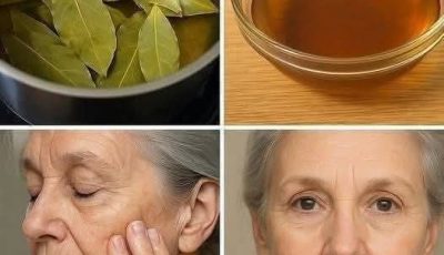 DIY Bay Leaf Skin Treatment