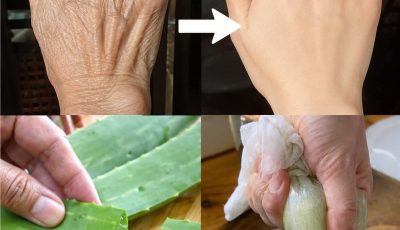 Aloe Vera + the Skin-Deep Flush That Hits Joints, Veins, and Dry, Cracked Tissue