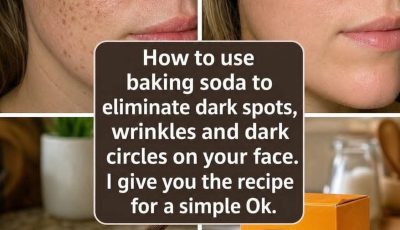 How to use baking soda to remove dark spots, wrinkles and dark circles from your