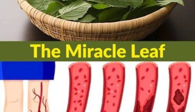 7 Healing Leaves That Naturally Support Diabetes, Blood Pressure, Pain Relief, Cholesterol, and Circulation