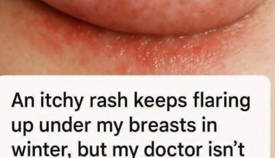 What to Do Today if You Have an Itchy Rash Under Your Breasts in Winter