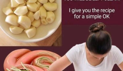 Garlic eliminates parasites in just 1 day? What you really should know before trying it