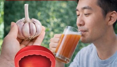 Nettle for Prostate Health: Benefits, How to Prepare It, and Important Precautions