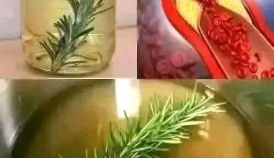 This Liquid Cleans Blood Vessels, and Cholesterol is as if it Never Existed: Rosemary Tea