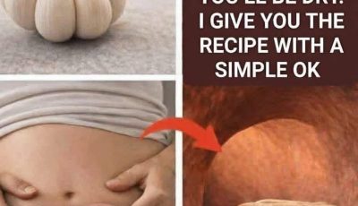 Garlic eliminates parasites in just 1 day? What you really should know before trying it