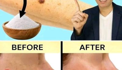 Baking Soda: Your Secret Weapon for Beautiful Skin
