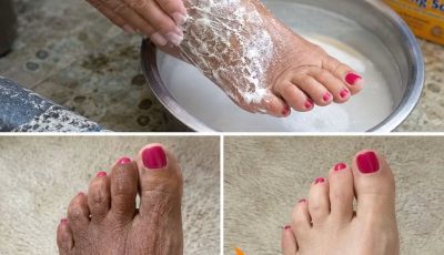 Baking Soda on Your Feet: The One Soak That Softens Hard, Cracked Skin