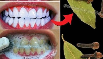 Goodbye Tartar: How to Remove It and Brighten Your Smile Naturally (Without Damaging Enamel)