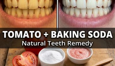 Tomato and Baking Soda for Teeth Whitening? The DIY Whitening Remedy That Sounds Natural but Can Backfire