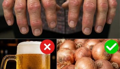 Arthritis and Diet: 7 Foods Many People Choose to Limit for Better Joint Health