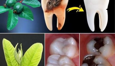 Guava Leaves + Oral Hygiene: What You Should Know