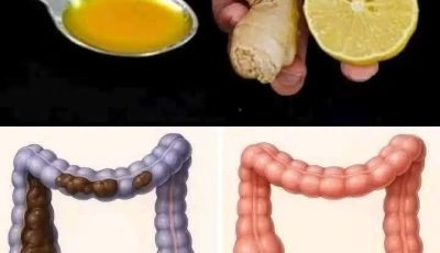 The Miracle Drink That Flushes Out 15kg of Toxins from Your Gut and Blood Vessels – Time-Tested Formula