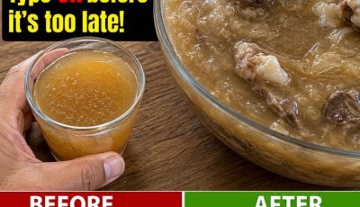 Seniors: 6 Proteins That Overload Your Kidneys Fast