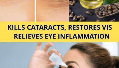 The Benefits of Castor Oil for Eye Health