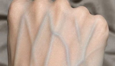 Visible Veins on Your Hands? Here’s What They Could Mean for Your Health