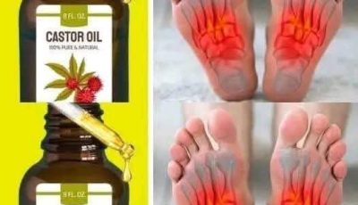Castor oil: More information