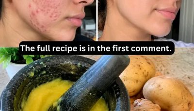 Potato and Ginger for Dark Spots: The Fast Skin Brightener Hidden in Your Kitchen