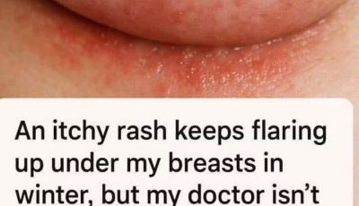 An itchy rash keeps flaring up under my breasts in winter, but my doctor isn’t available right now. What can I do today?
