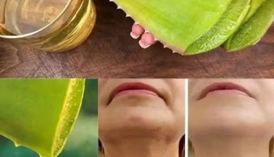 1000 Times Stronger Than Botox! Natural Collagen Aloe Vera! Erases All