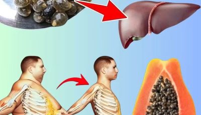 17 Amazing Benefits of Papaya Seeds and How to Use Them as Natural Remedies