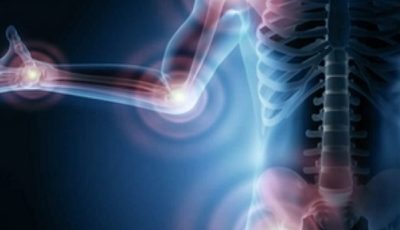 Causes and treatment of sudden joint pain
